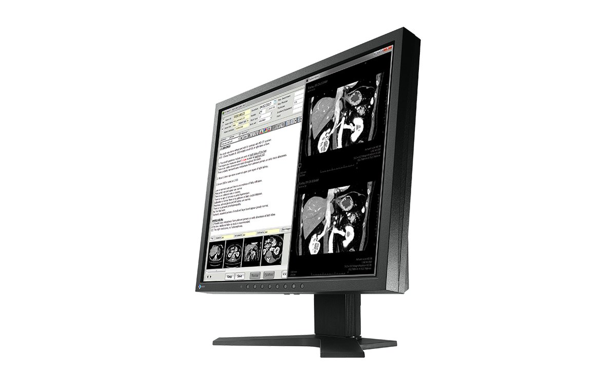 Eizo RadiForce MX194